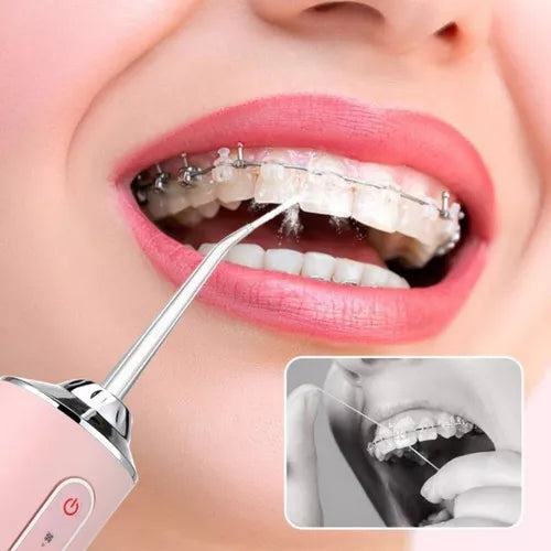 Irrigador Dental Portatil Melhor Que Power Jet